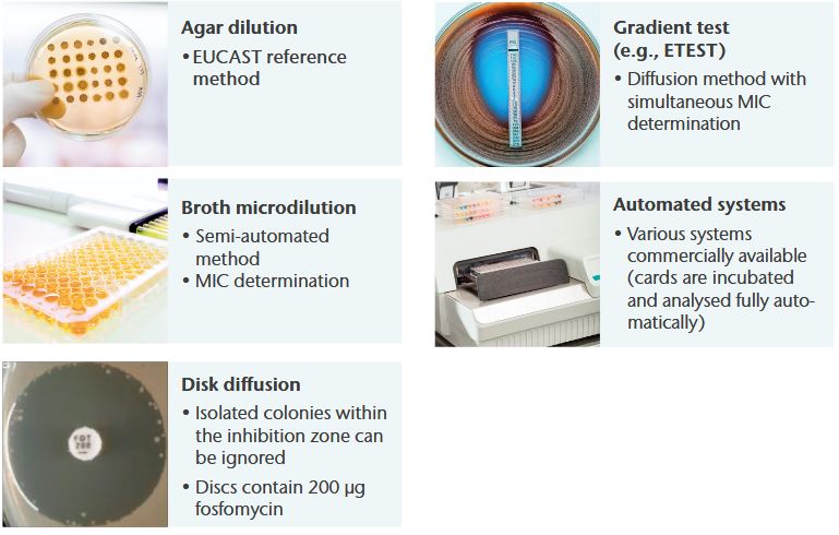 AST methods for IV Fosfomycin AST methods for IV Fosfomycin