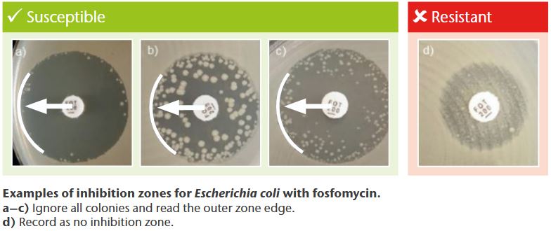 Inhibition Zones Inhibition Zones